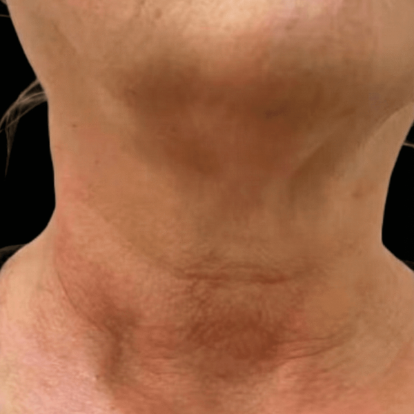 Gemini_Generated_Image_fk46zjfk46zjfk46_cleanup (1)